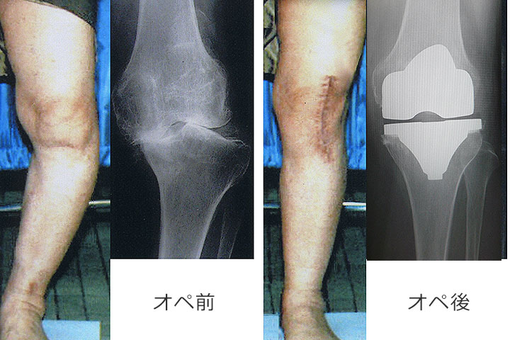お悩み相談q A 福岡県古賀市 医療法人 亀山整形外科医院 優れた専門性を生かし 腰 膝 肩の検査 診断に即応します